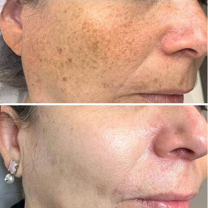 Facial Skin Fade Spots Anti-wrinkle Lifting Tightening Moisturizing Oil - terrifictrend