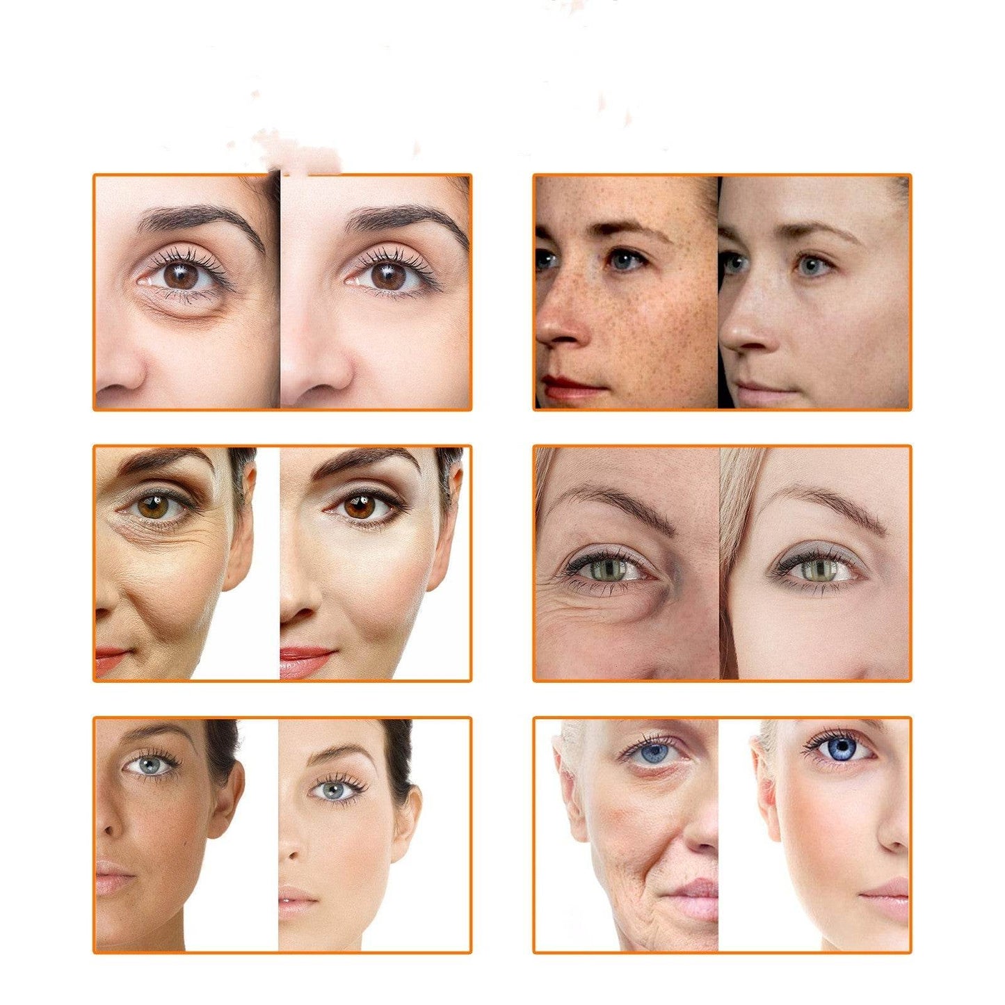 Facial Skin Fade Spots Anti-wrinkle Lifting Tightening Moisturizing Oil - terrifictrend
